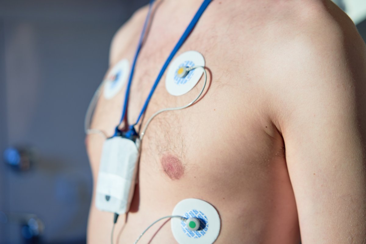holter installato su una persona
