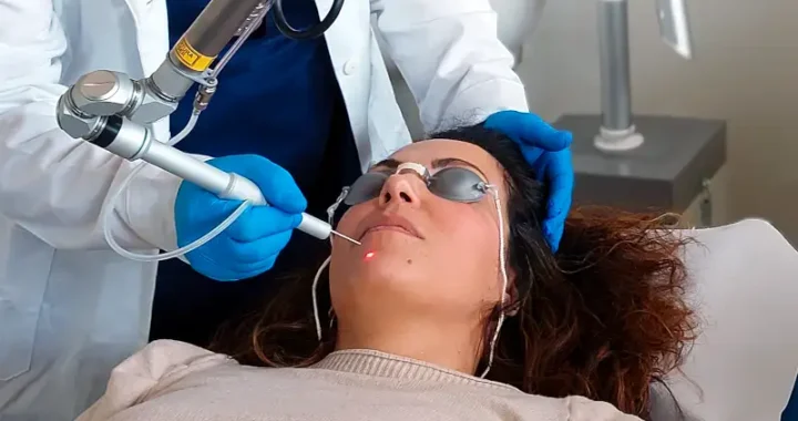 paziente durante un'applicazione del laser CO2